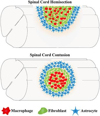 Fibrotic Scar After Spinal Cord Injury: Crosstalk With Other Cells, Cellular Origin, Function, and Mechanism